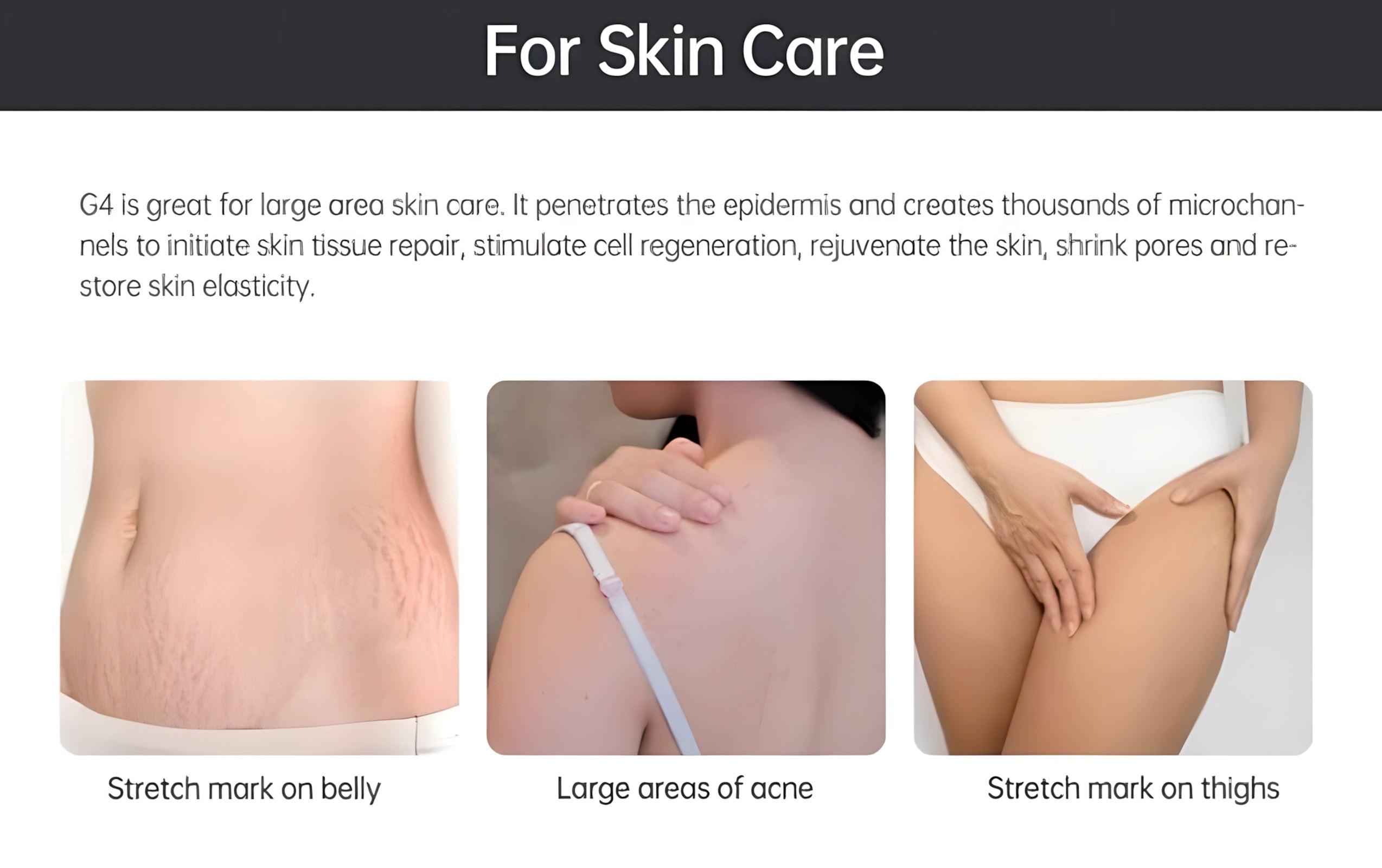 Bio Roller G4 Hair Growth & Skin