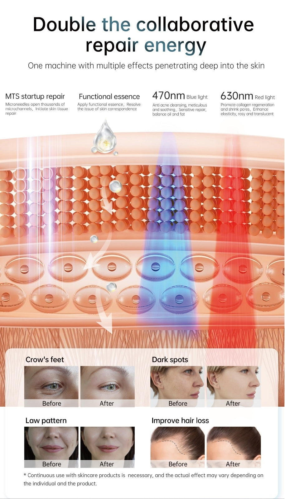 Dr.pen® Hydra Pen H6