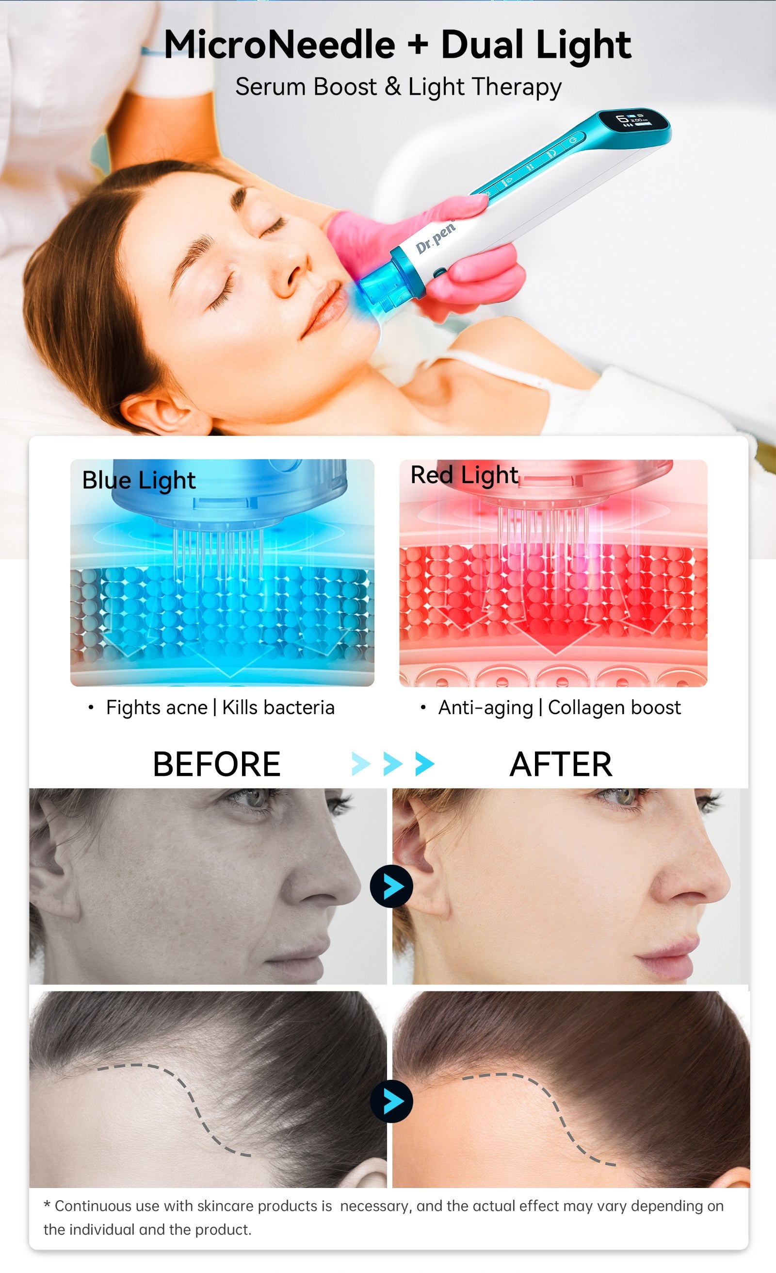 Dr.pen® Hydra Pen H6