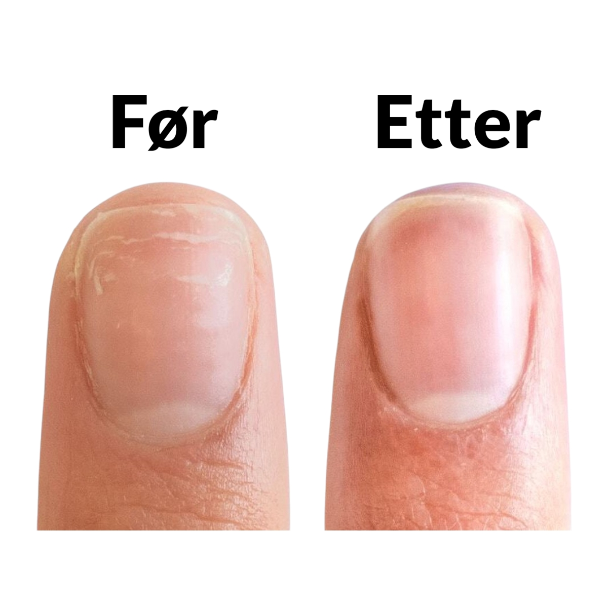 CND™ Strengthener RXx Fortifiant RXx 15ml