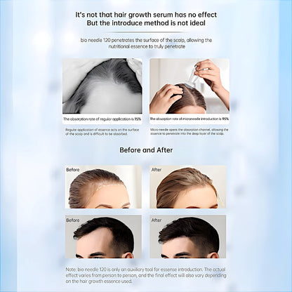 Bio Needle 120 Adjustable Needle Size