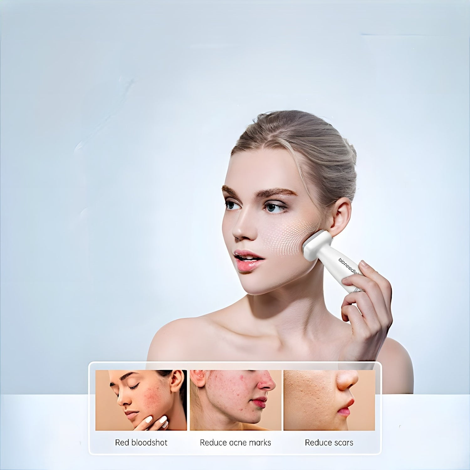 Bio Needle 120 Adjustable Needle Size