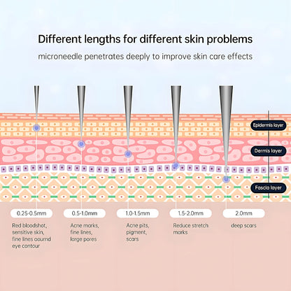 Bio Needle 120 Adjustable Needle Size