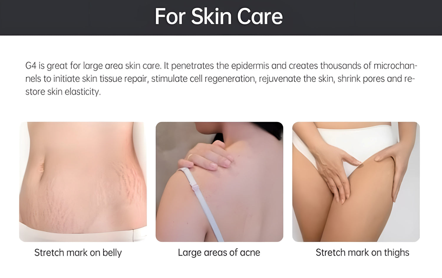 Bio Roller G4 Hair Growth &amp; Skin