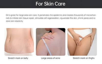 Bio Roller G4 Hair Growth &amp; Skin