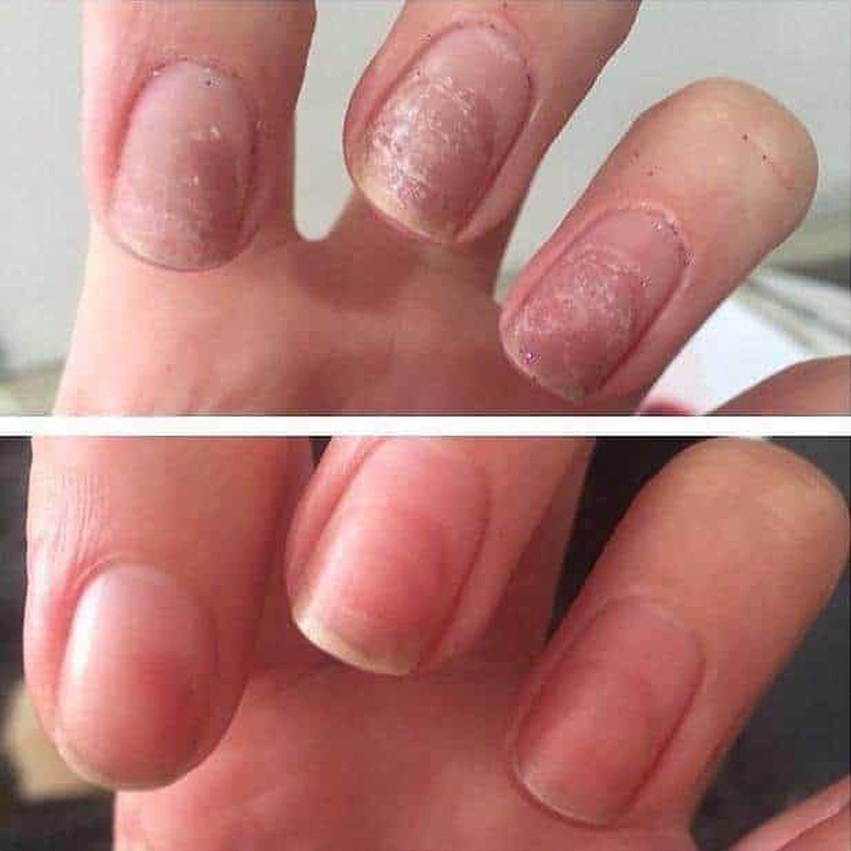 CND™ Rescue RXx Daily Nail Keratin Treatment 15ml