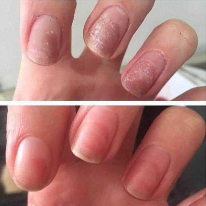 CND™ Rescue RXx Daily Nail Keratin Treatment 15ml