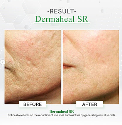 Dermaheal SR Skin Rejuvenating Solution 5ml
