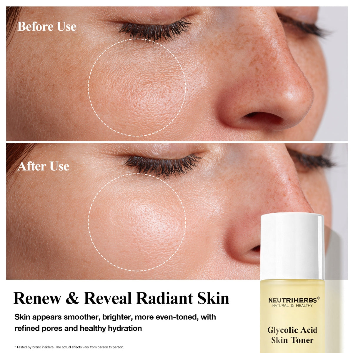 Neutriherbs® Glycolic Acid Skin Toner 100ml